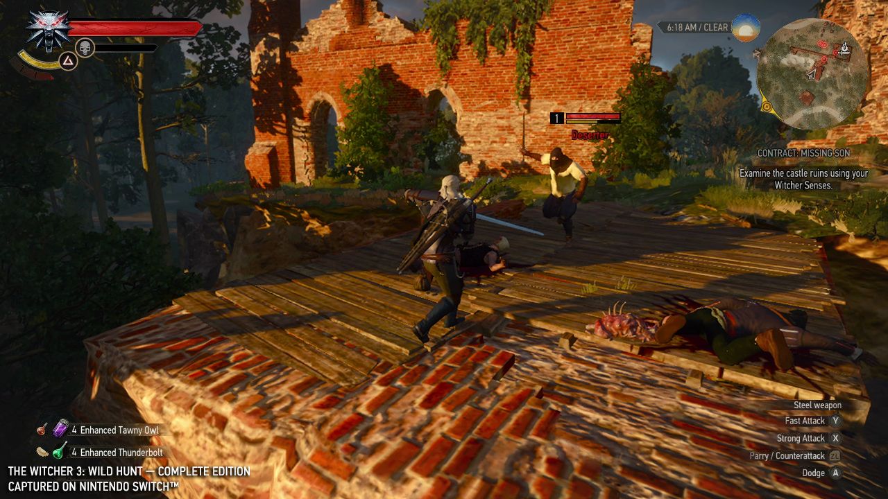 witcher wont hurt a bit